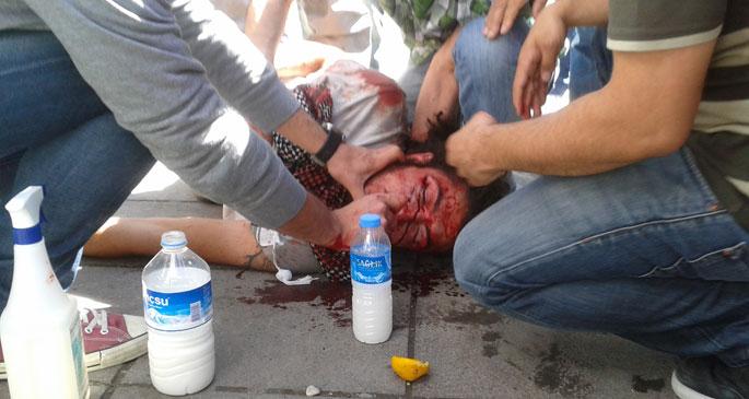 Gezi yaralısı Mutlu Coşar\'a intikam gözaltısı