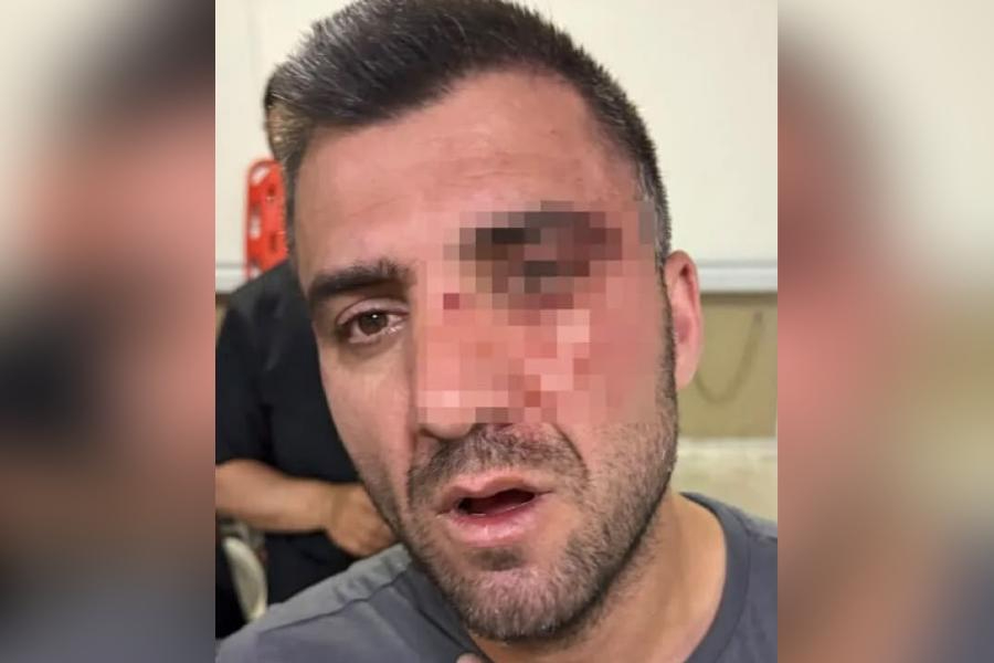 Van'da sağlıkçıya saldırı