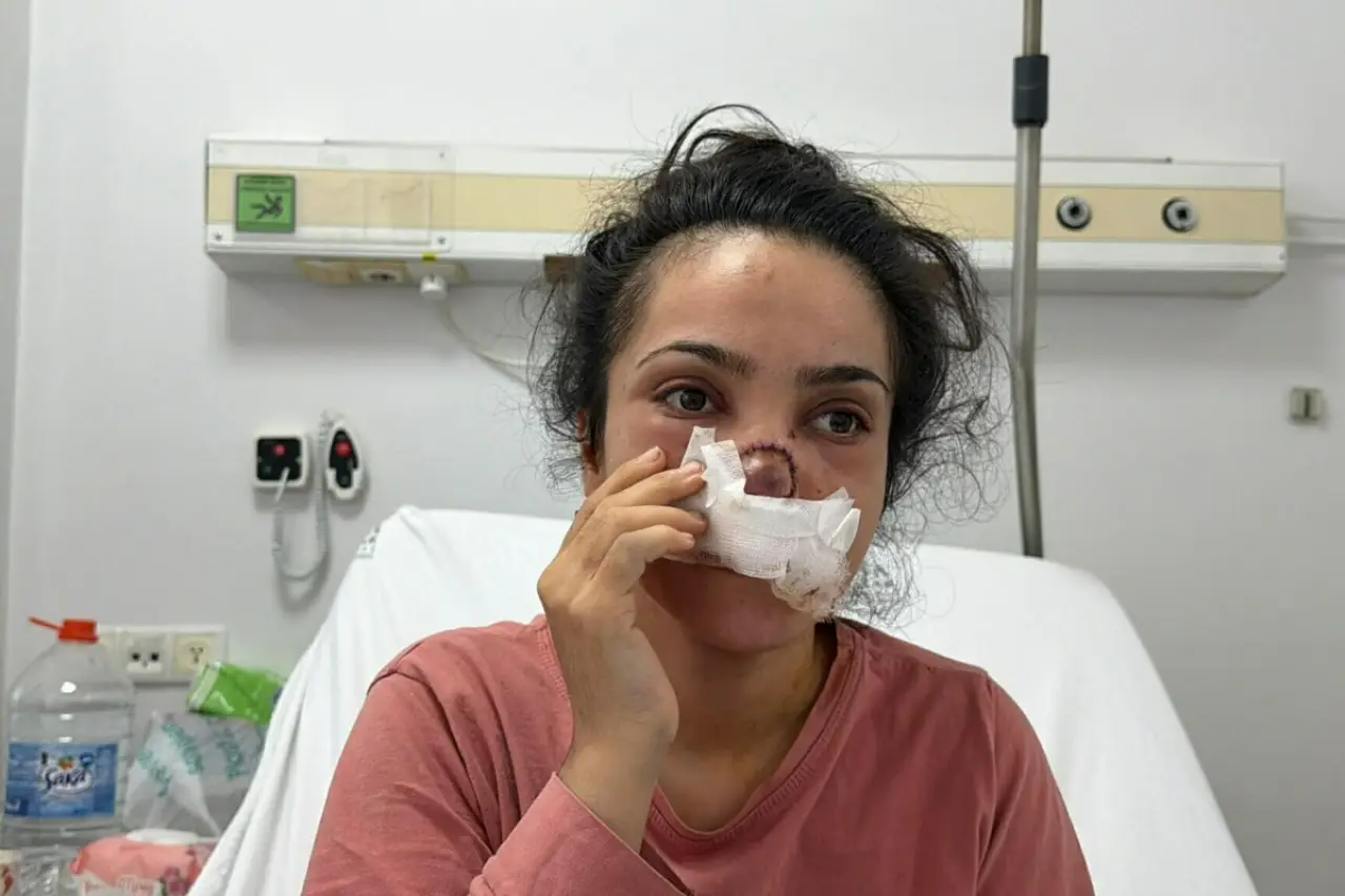 Evli olduğu erkek tarafından burnu ısırılıp koparılan İmran: 'Sonuna kadar şikayetçiyim'