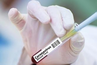 SASA’da bazı işçiler koronavirüs kaptı, diğer işçiler test yapılmadan eve gönderildi