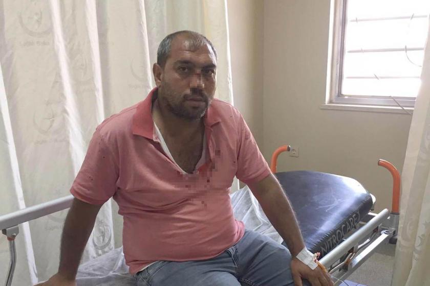 Sivil polis, kimliğini göstermesini isteyen sağlık çalışanının burnunu kırdı
