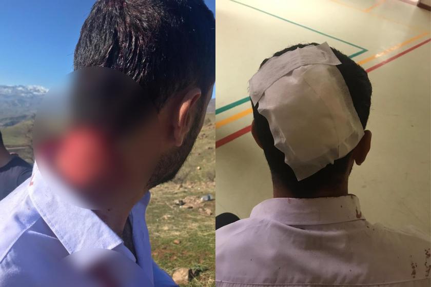 Derecik’te askerlerin açtığı ateş sonucu bir genç başından yaralandı