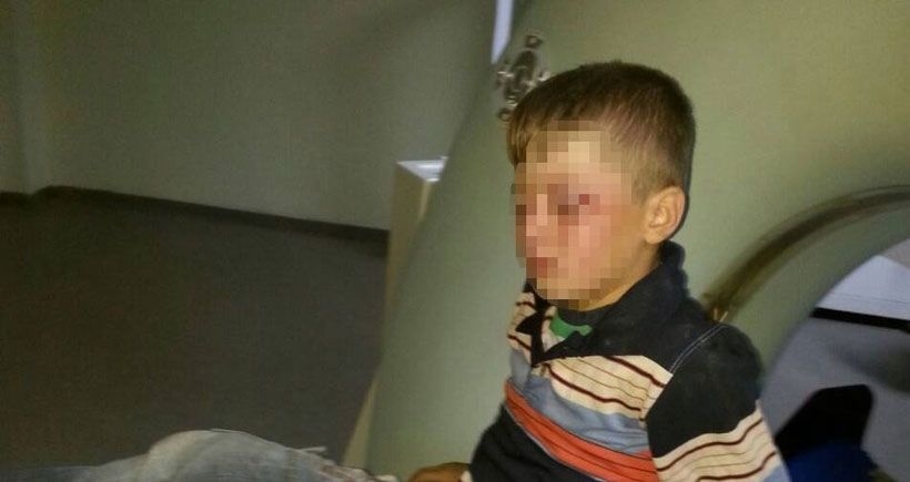 Polisin vurduğu 8 yaşındaki çocuğun tedavisi sürüyor