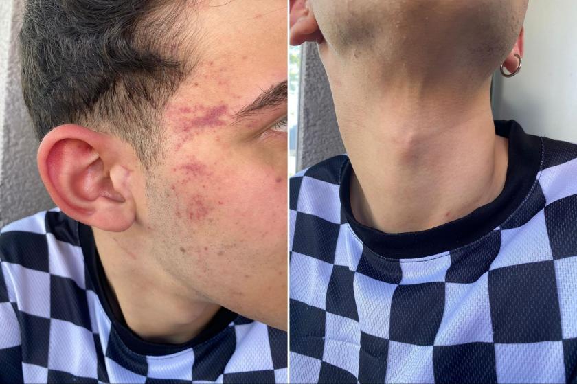 16 yaşındaki çocuk anlattı: ‘Nefes alamıyorum’ dedim, boğazımı daha çok sıktı