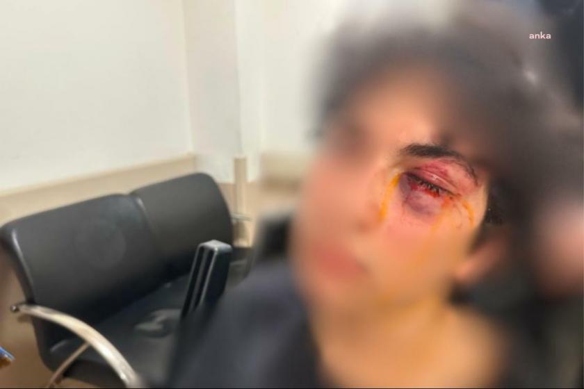 CHP standında 15 yaşındaki çocuğa saldırı iddiası: "Kurtuluş Yok Tek Başına" şarkısını söylediği için yumruklandı