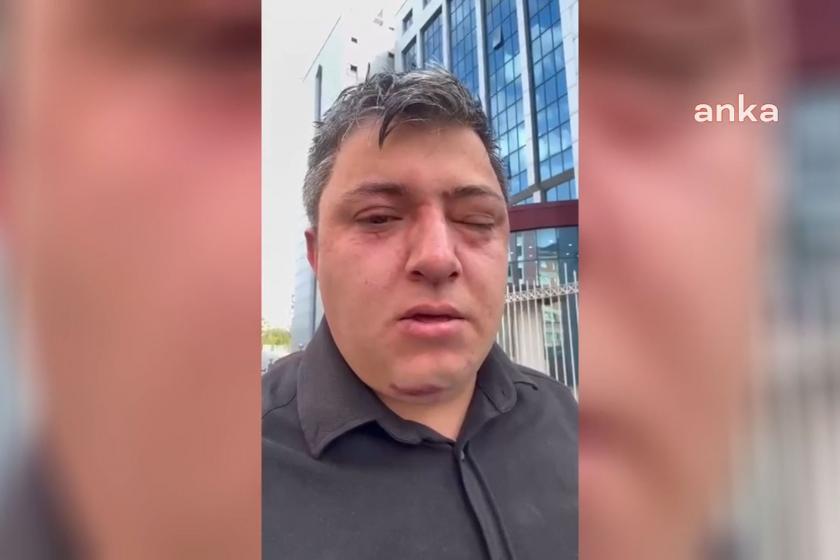 Altındağ Belediyesi işçisini darbeden zabıta müdürü tutuklandı