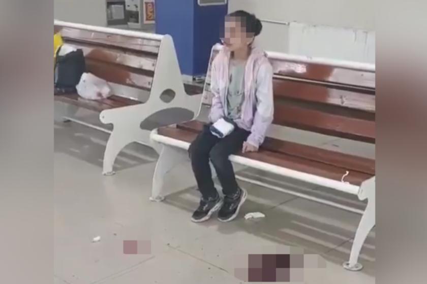 Yaralı çocuğa ambulans yok | Ambulanssız sevk edilirken kanama başladı