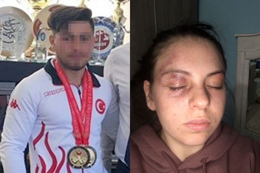 Milli sporcu eşinin şiddetinden sağ kurtulan kadın: “Birkaç saniye daha sürseydi ölebilirdim”