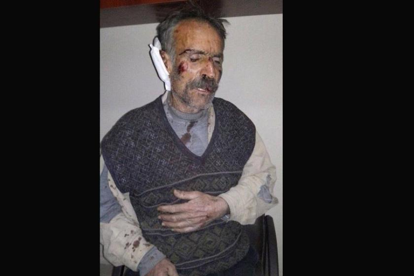 Koruköy’de işkence edilen Abdi Aykut tutuklandı