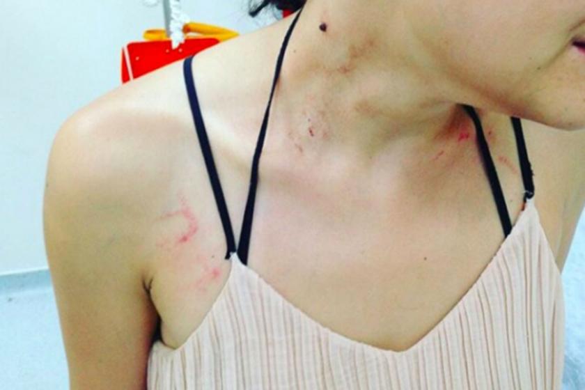 Kadıköy'de polis, bir müzisyeni 'terörist' diyerek darbetti